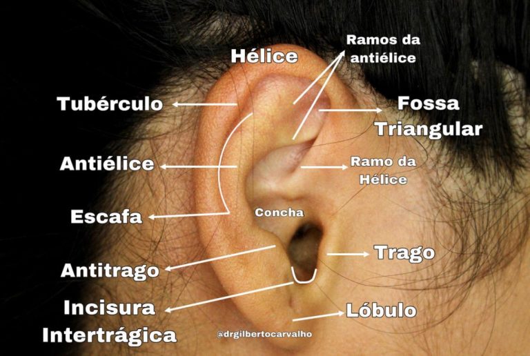 Traumatologia Forense Aplicada E Identificação Pela Orelha - Dr. Mário ...